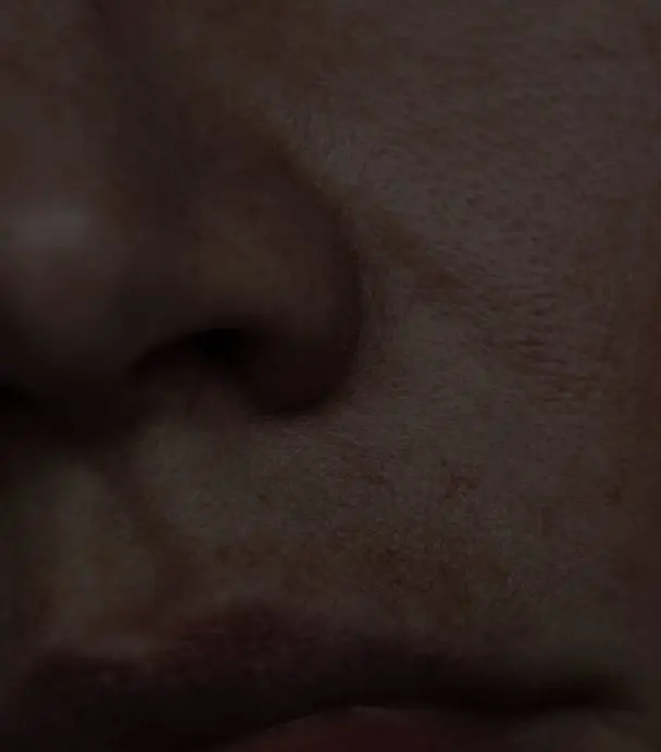 Open/Enlarged Pores