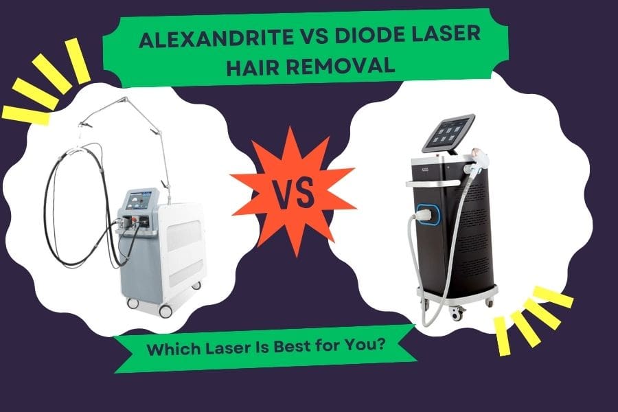 Alexandrite vs Diode Laser Hair Removal