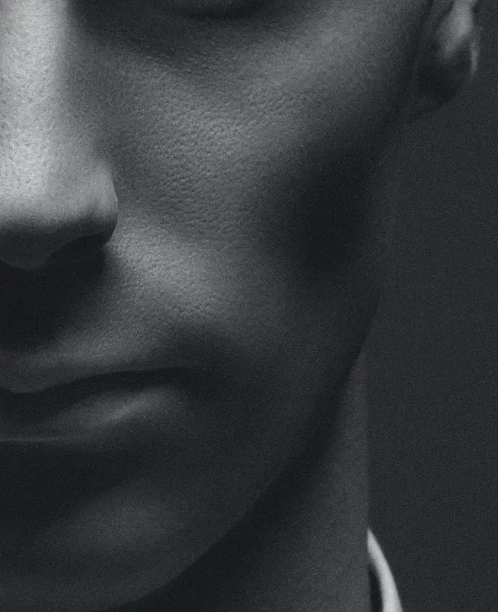 Contoured/Gaunt Cheeks