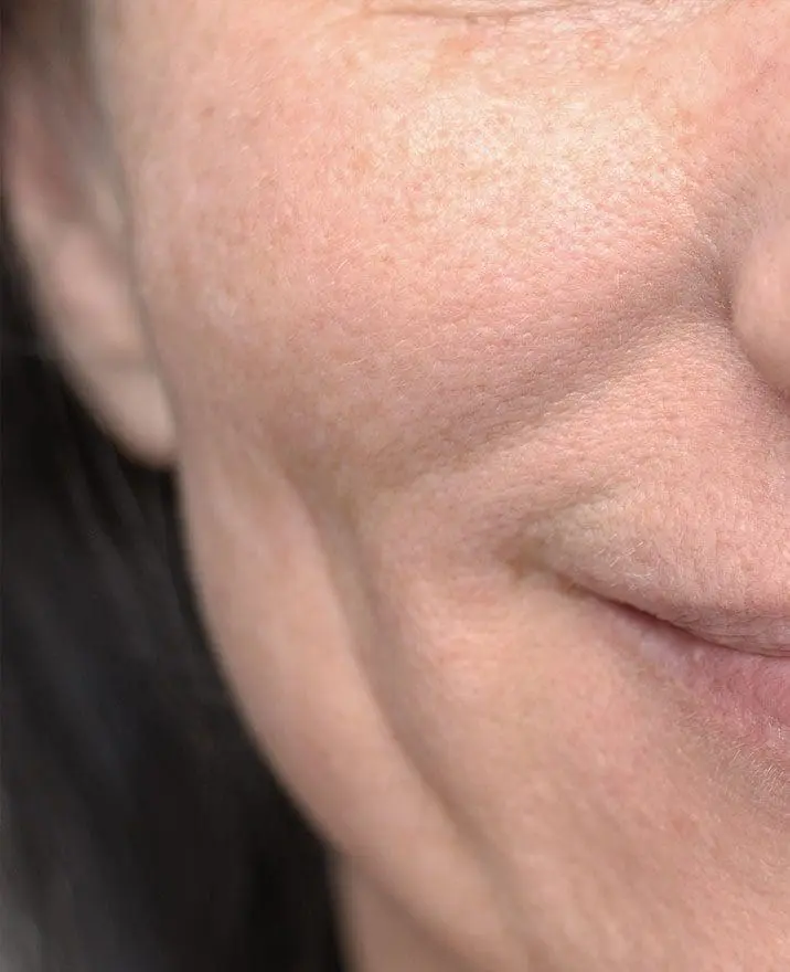 Smile, Sad (Marionette) Lines