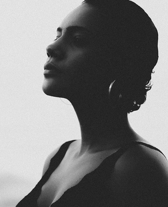 Profhilo Hyaluronic Acid Injection (5-Point Mini Facelift)