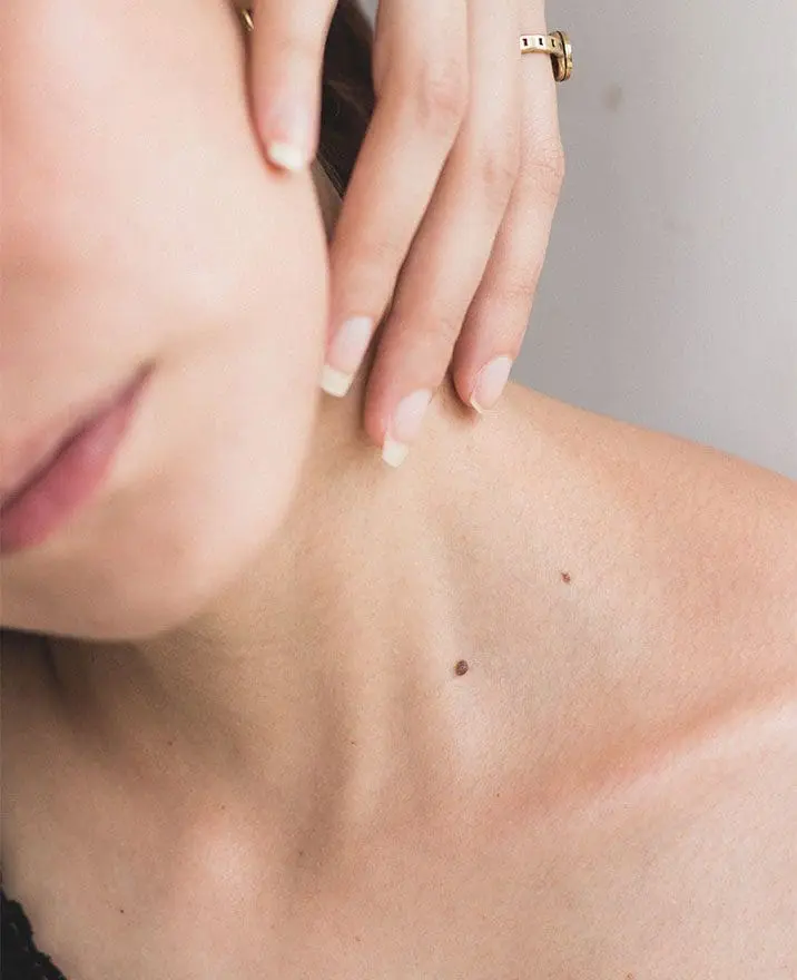 Skin Tag and Mole Removal