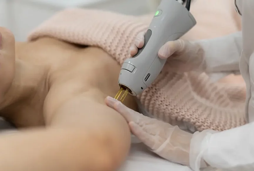 Laser Hair Removal: The Ultimate Solution to Get Rid of Unwanted Hair