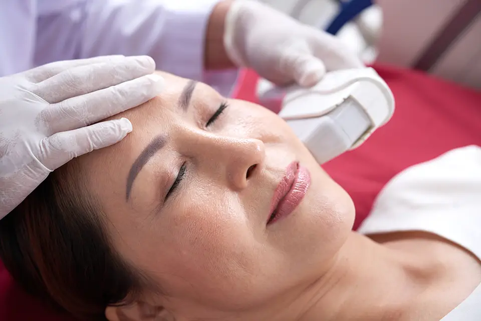 HIFU Treatment in London: The Hottest Non-Surgical Skin Tightening Trend